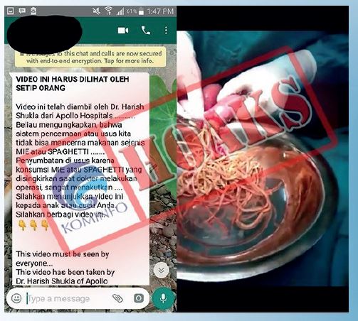 Operasi Penyumbatan Usus Akibat Mengkonsumi Mie Instan